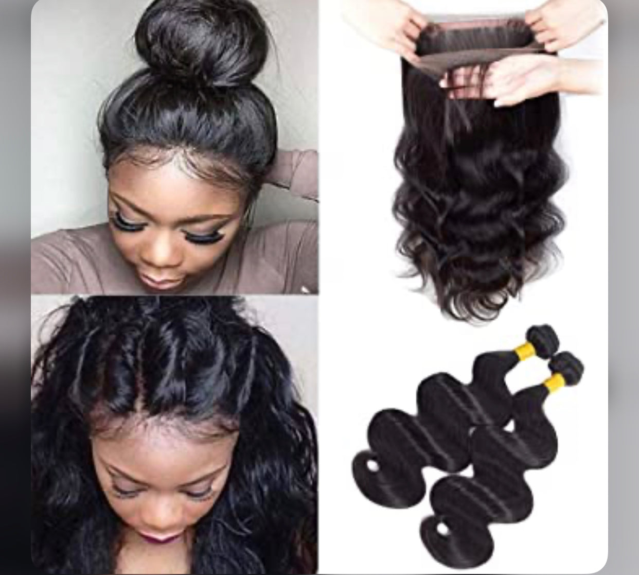 360 Frontals